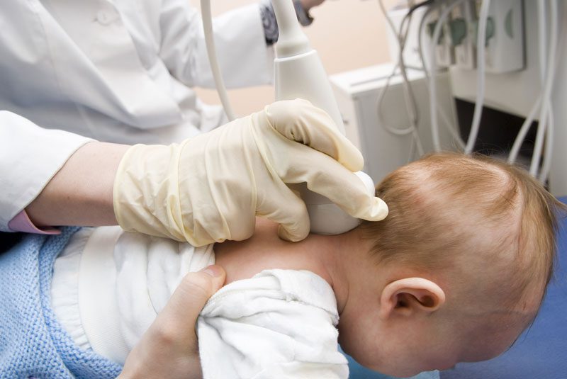 نوروسونوگرافی یا سونوگرافی سیستم عصبی نوزاد جیست